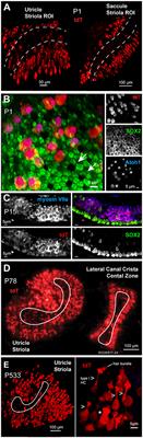 Spontaneous and Acetylcholine Evoked Calcium Transients in the Developing Mouse Utricle